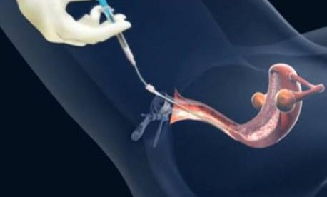 青岛即墨不孕不育（青岛即墨有不孕症的老中医么）